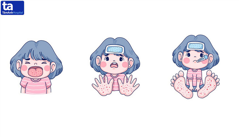 dau hieu mac tay chan mieng